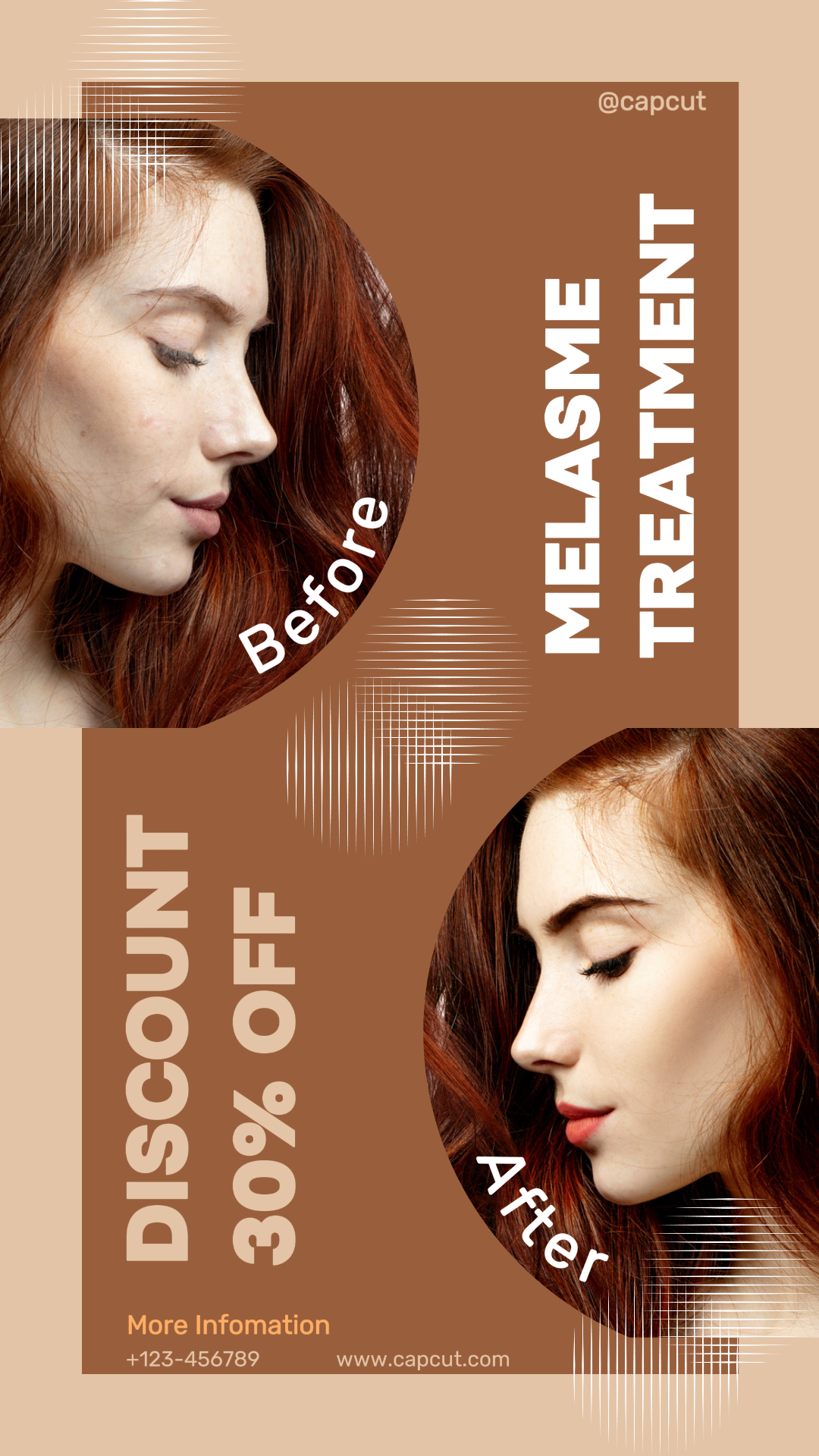 capcut template cover